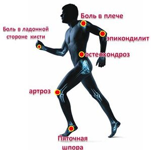 Лечение суставов в Москве